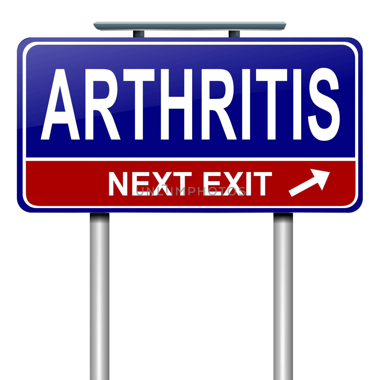 Illustration depicting a roadsign with an arthritis concept. White background.