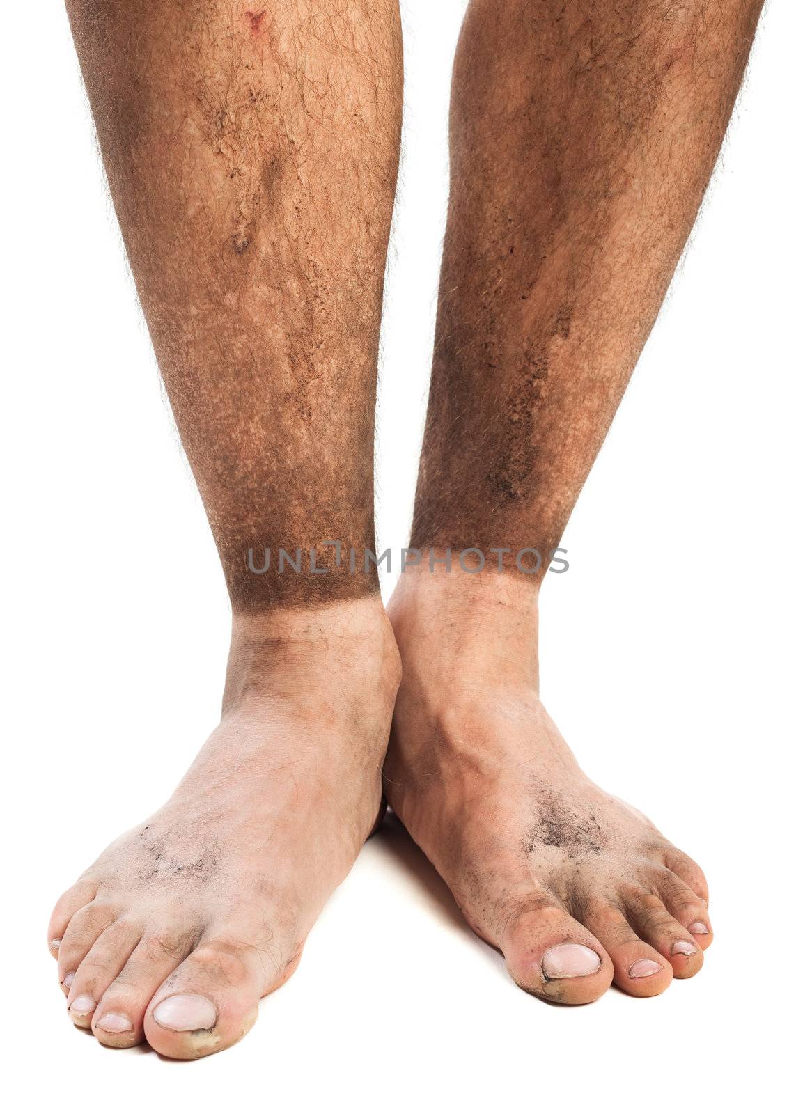 dirty feet in sand and mud with traces of socks