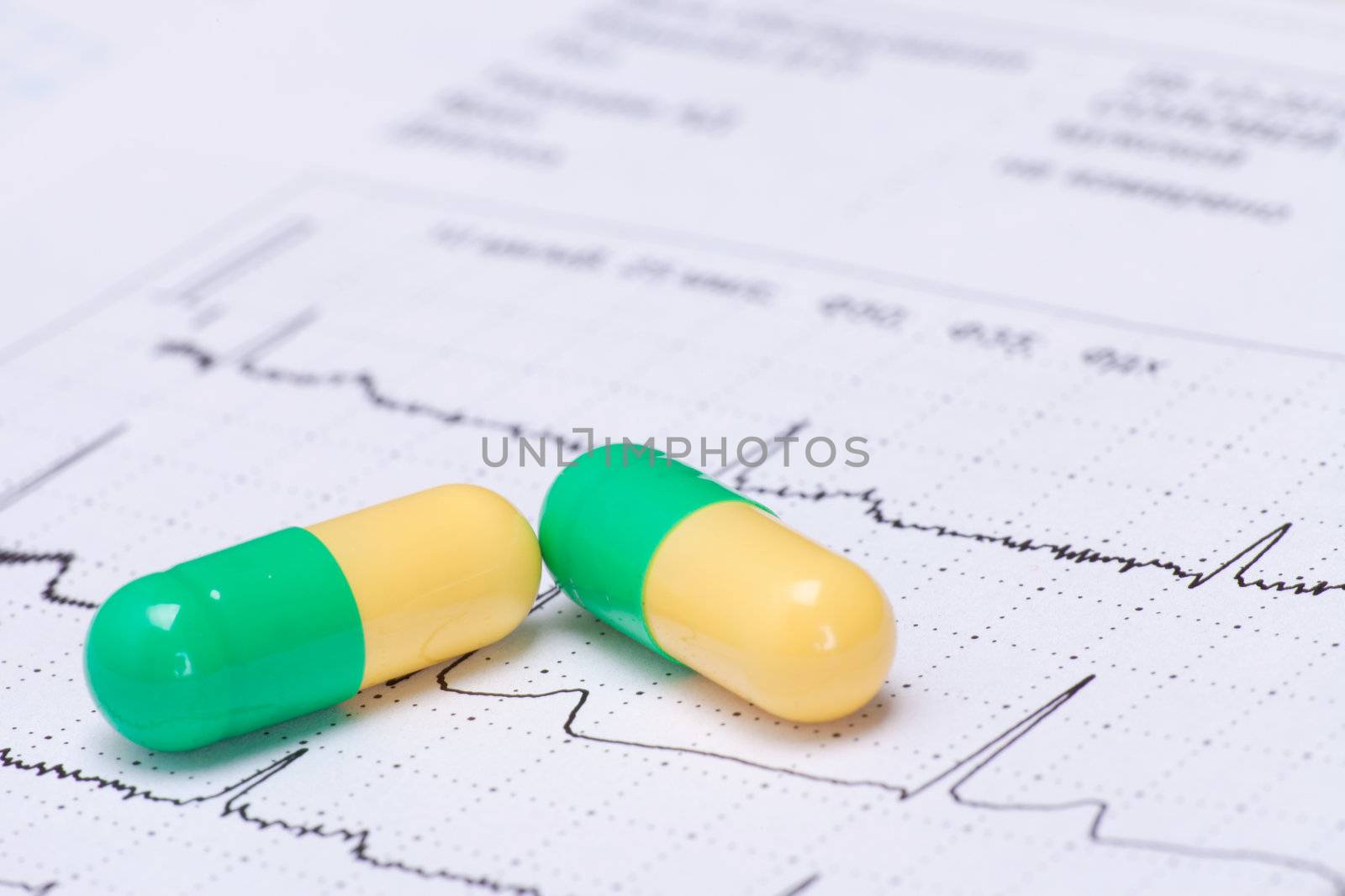Macro of pills lying on ECG diagram