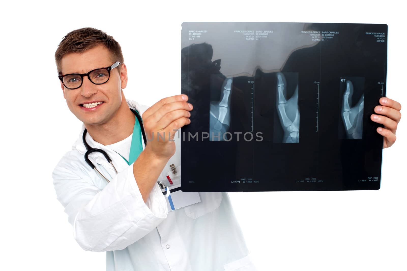Young specialist peeping from behind x-ray report looking at camera