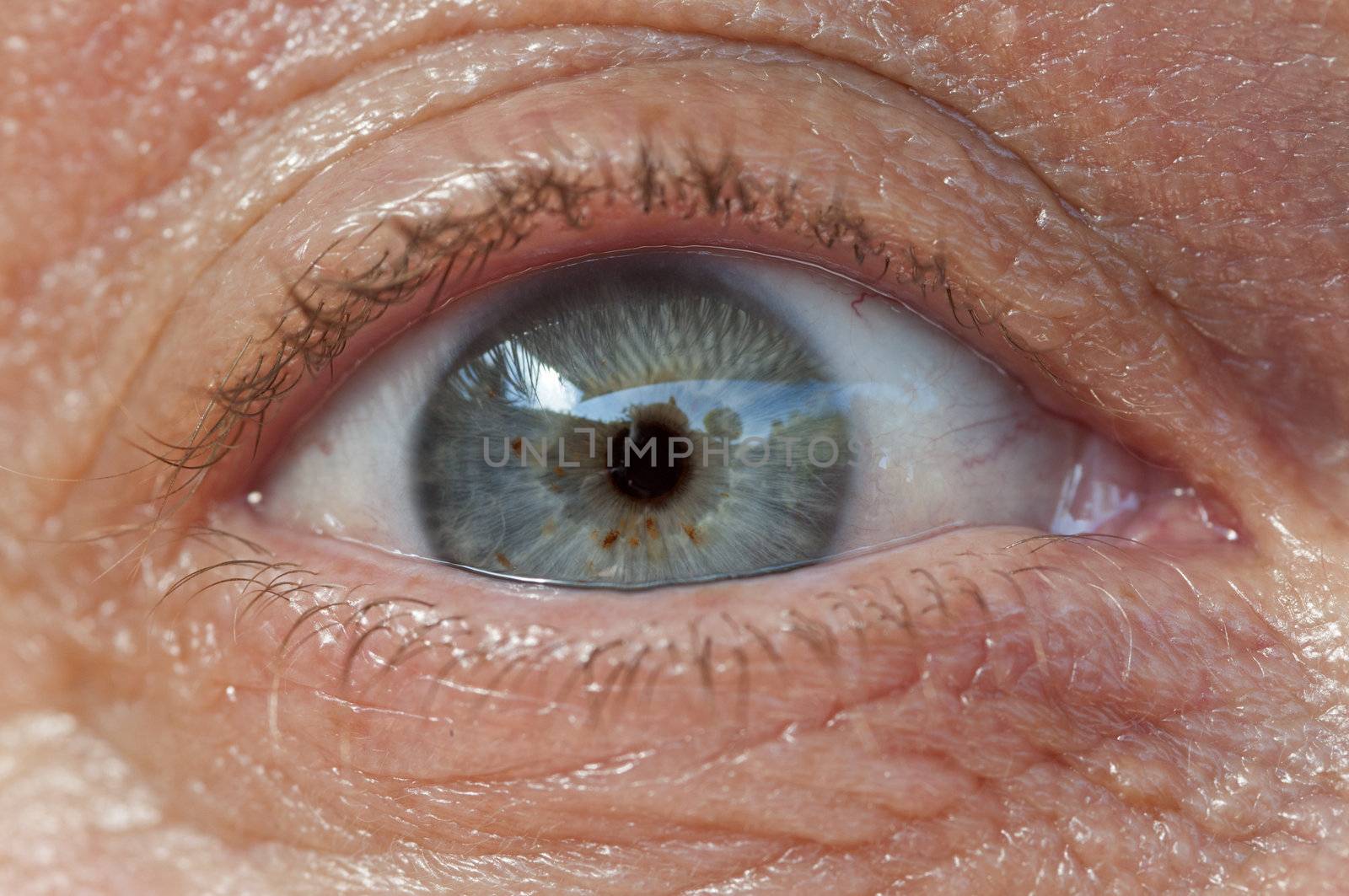 cmacro from a female eye