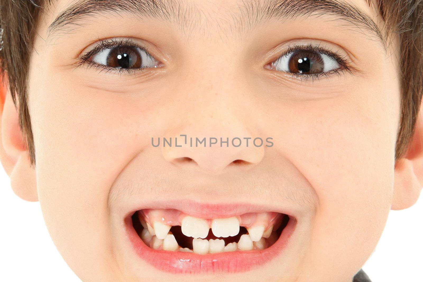 Attractive young boy with missing teeth close up detail.
