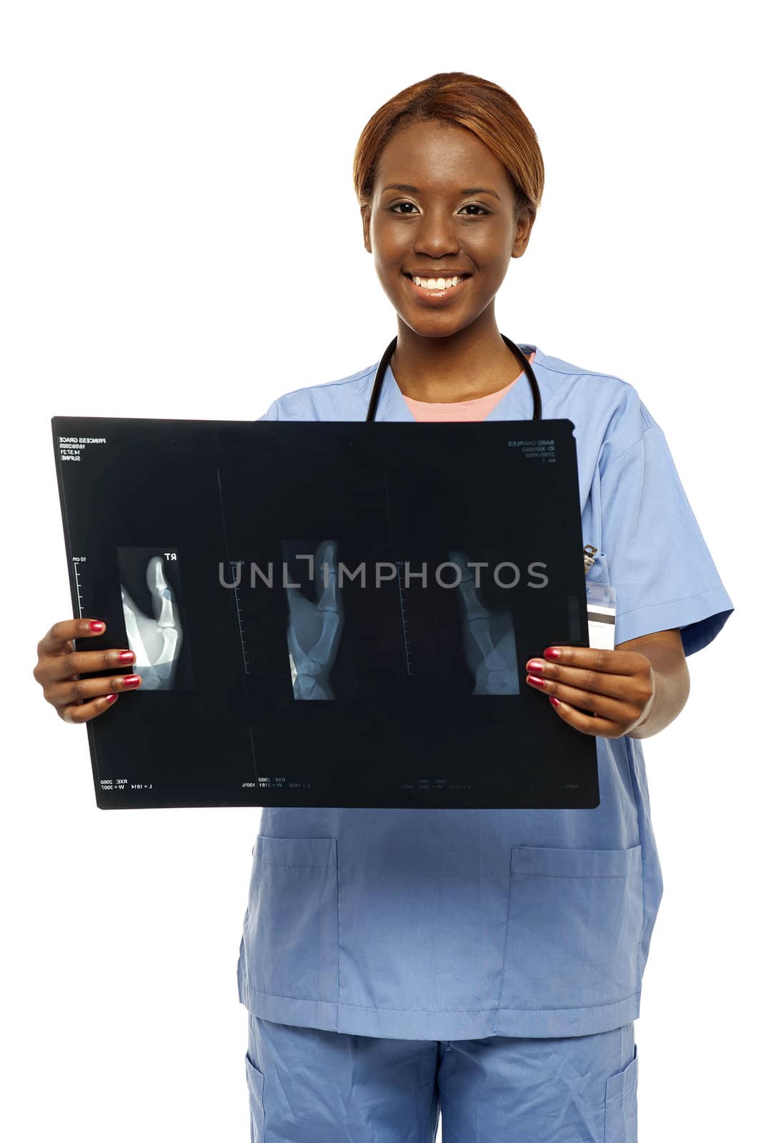 Medical expert holding patients x-ray report isolated over white background