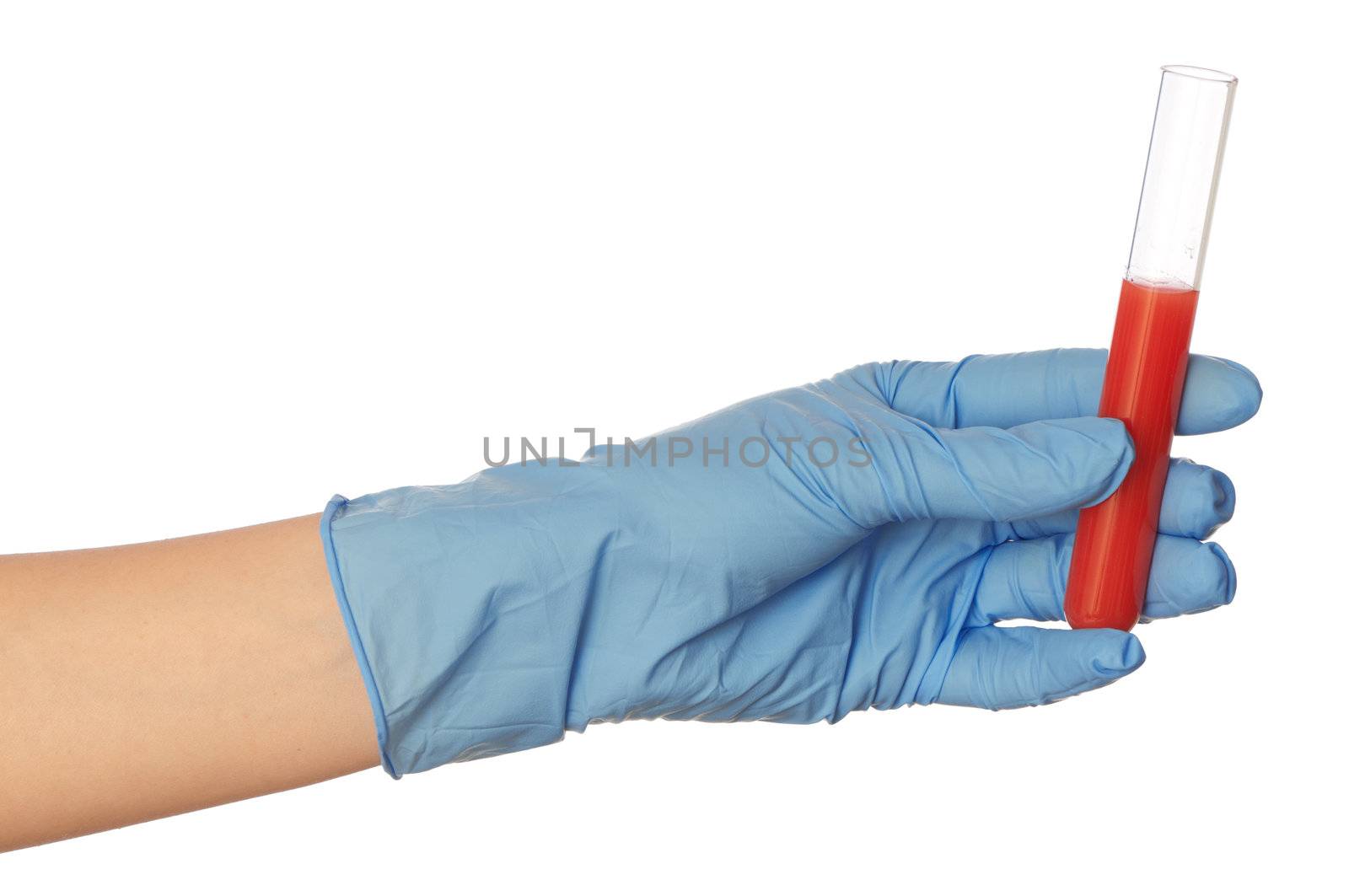 Doctor in blue gloves will be carry out research a samples of bloods at inhabitants of coast on availability of poisoning