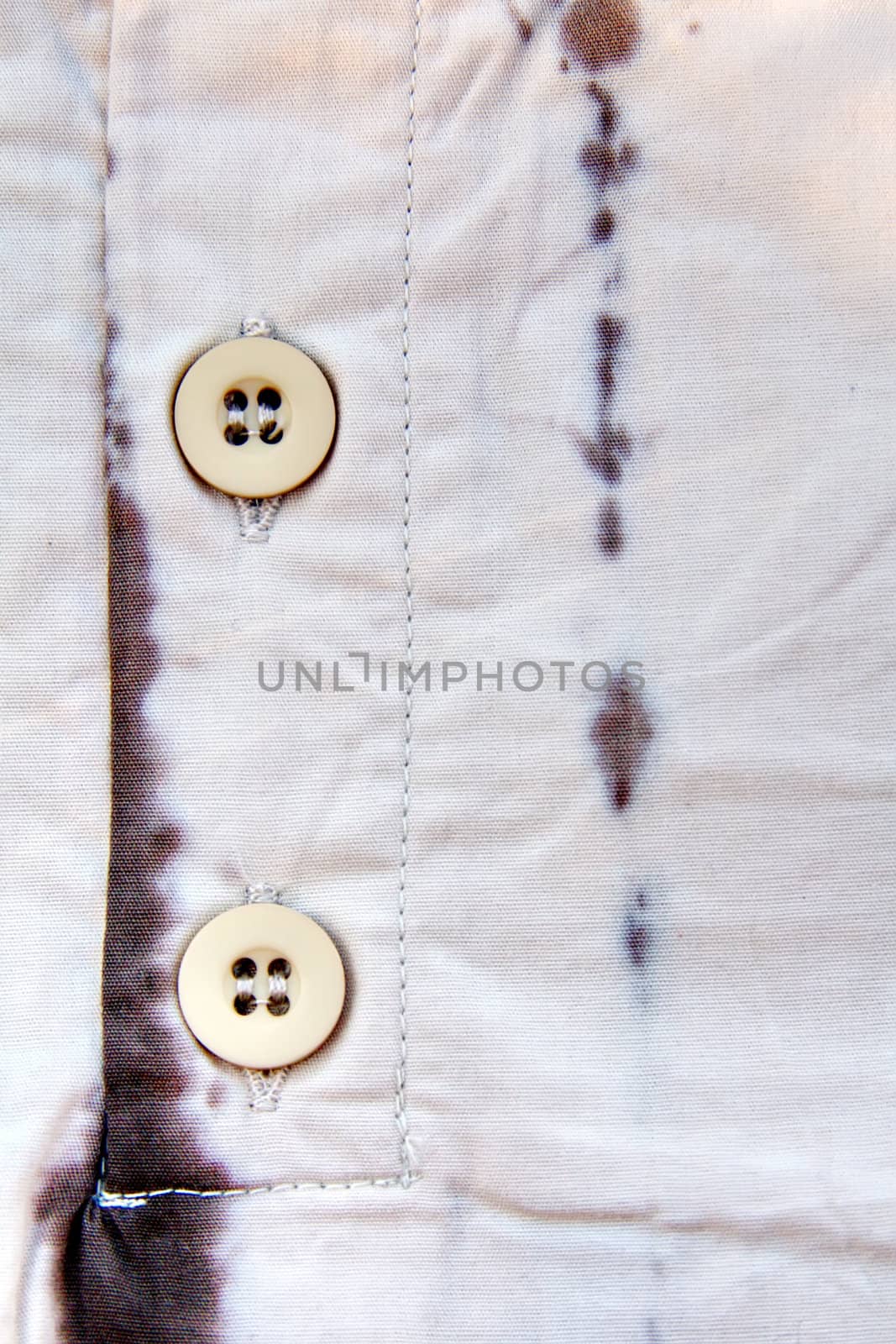 A part of a shirt with buttons