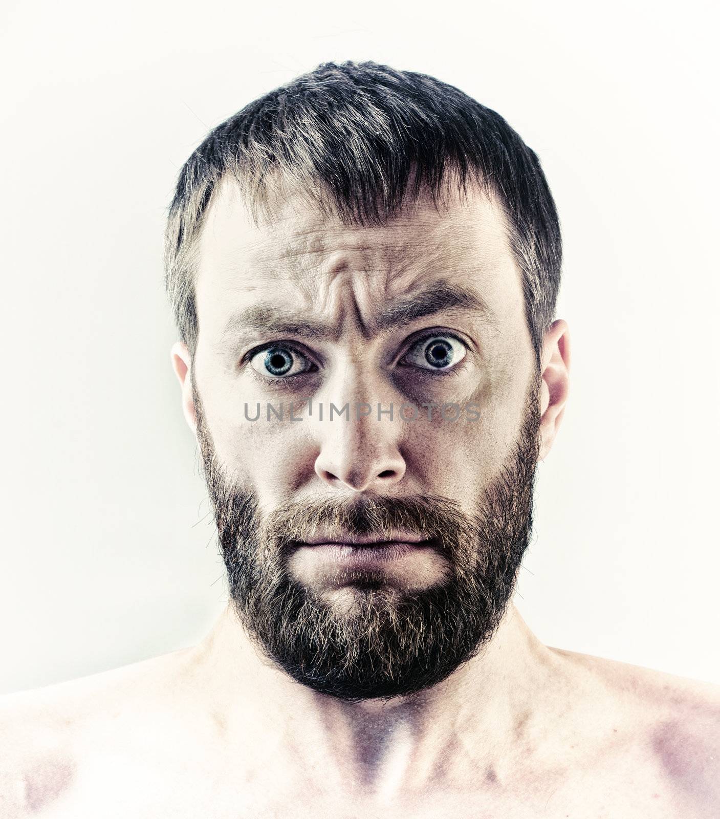 bearded wide eyes man portrait
