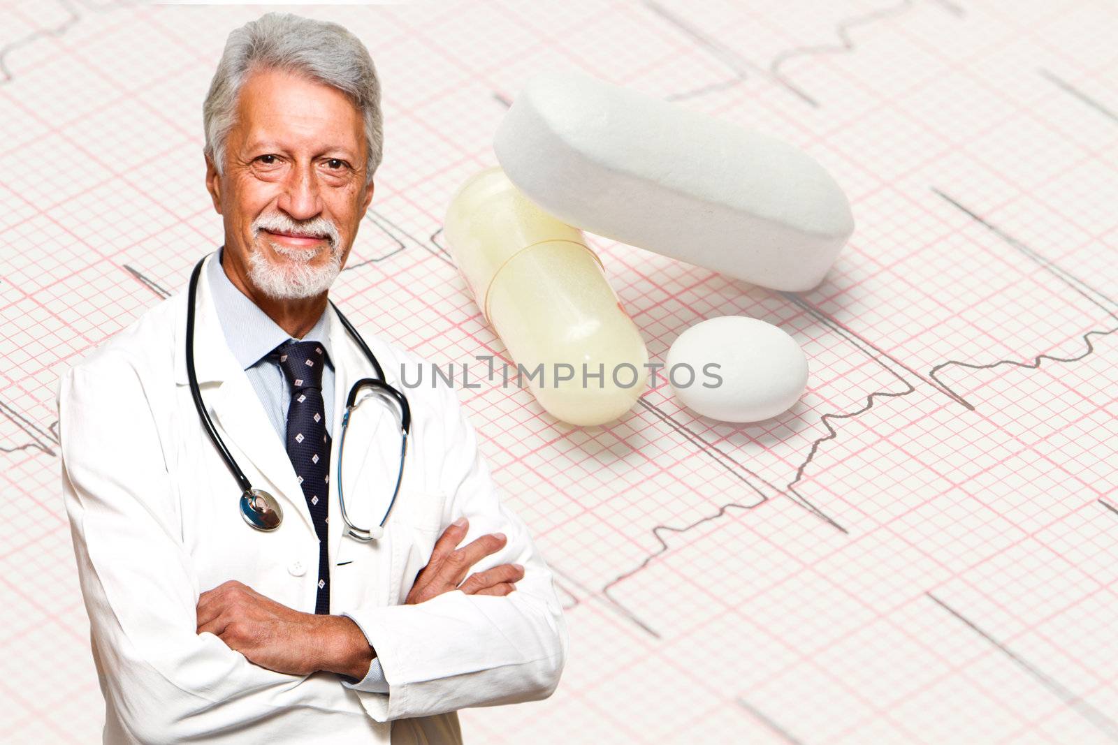 electrocardiogram