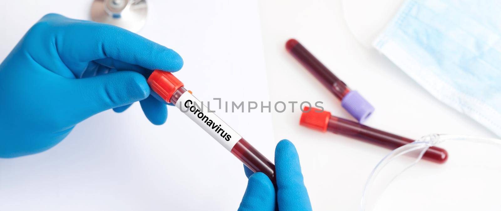 Coronavirus 2019-nCoV Blood Sample. by Taut
