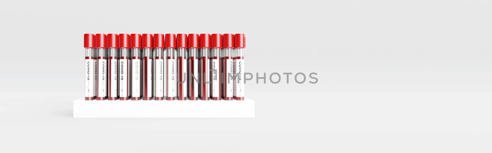 Coronavirus 2019-nCoV Blood Sample. 3D Rendering by Taut