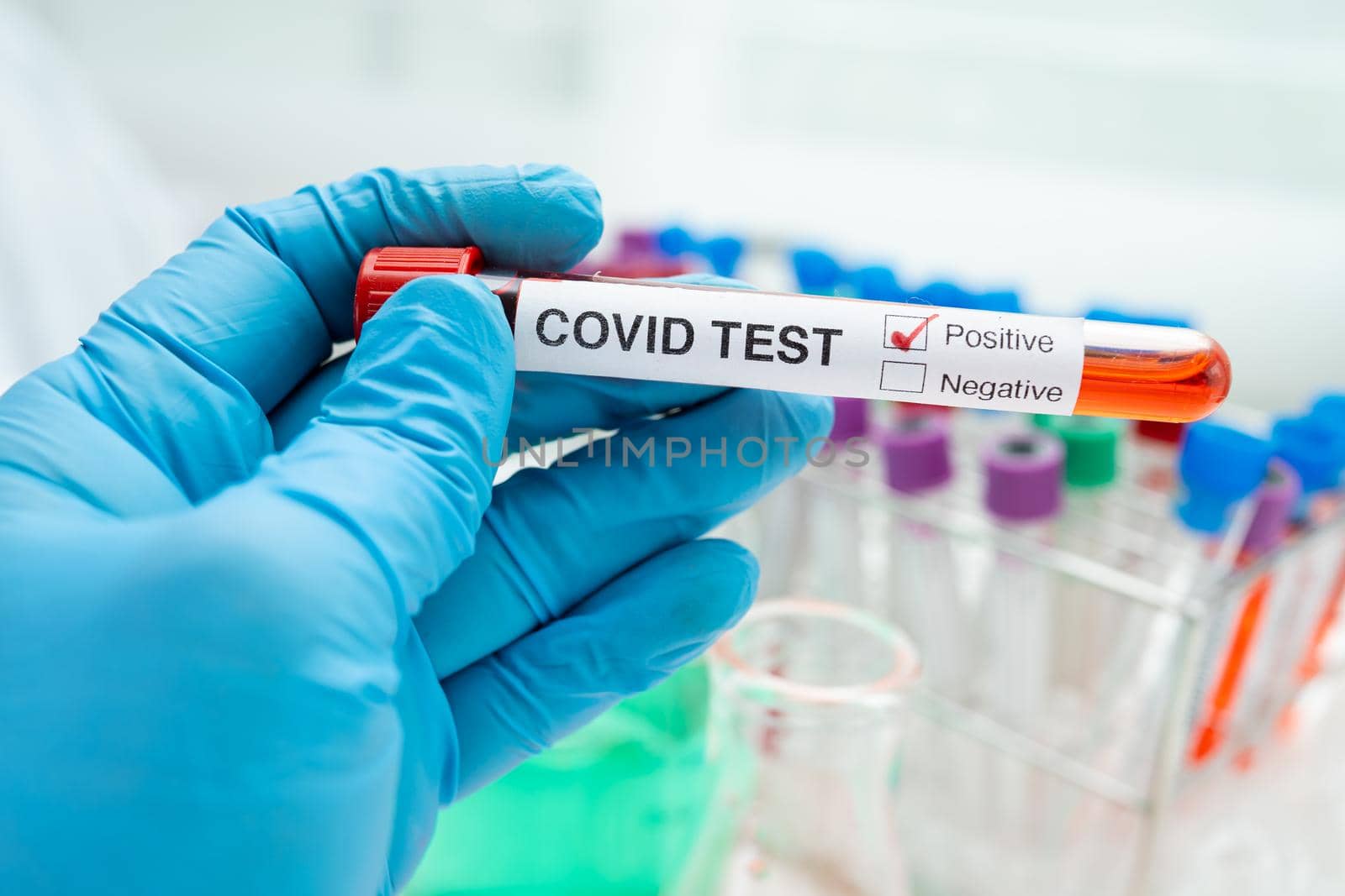 Positive blood infection sample in test tube for covid-19 coronavirus in lab. Scientist holding to check and analyze for patient in hospital.