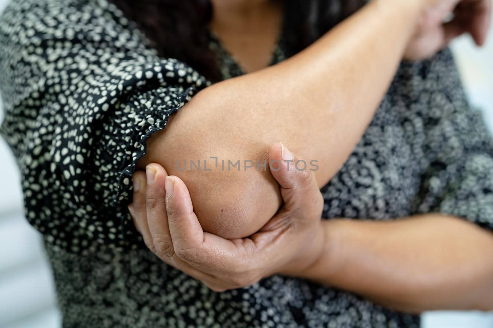 Asian middle-aged lady woman patient touch and feel pain her elbow and arm, healthy medical concept. by pamai