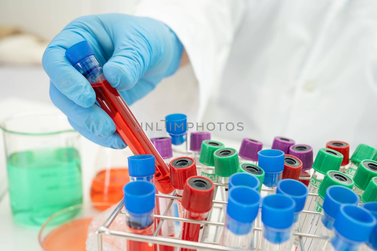 Scientist holding and analysis tube of micro biological sample with a microscope in laboratory for doctor in the world.