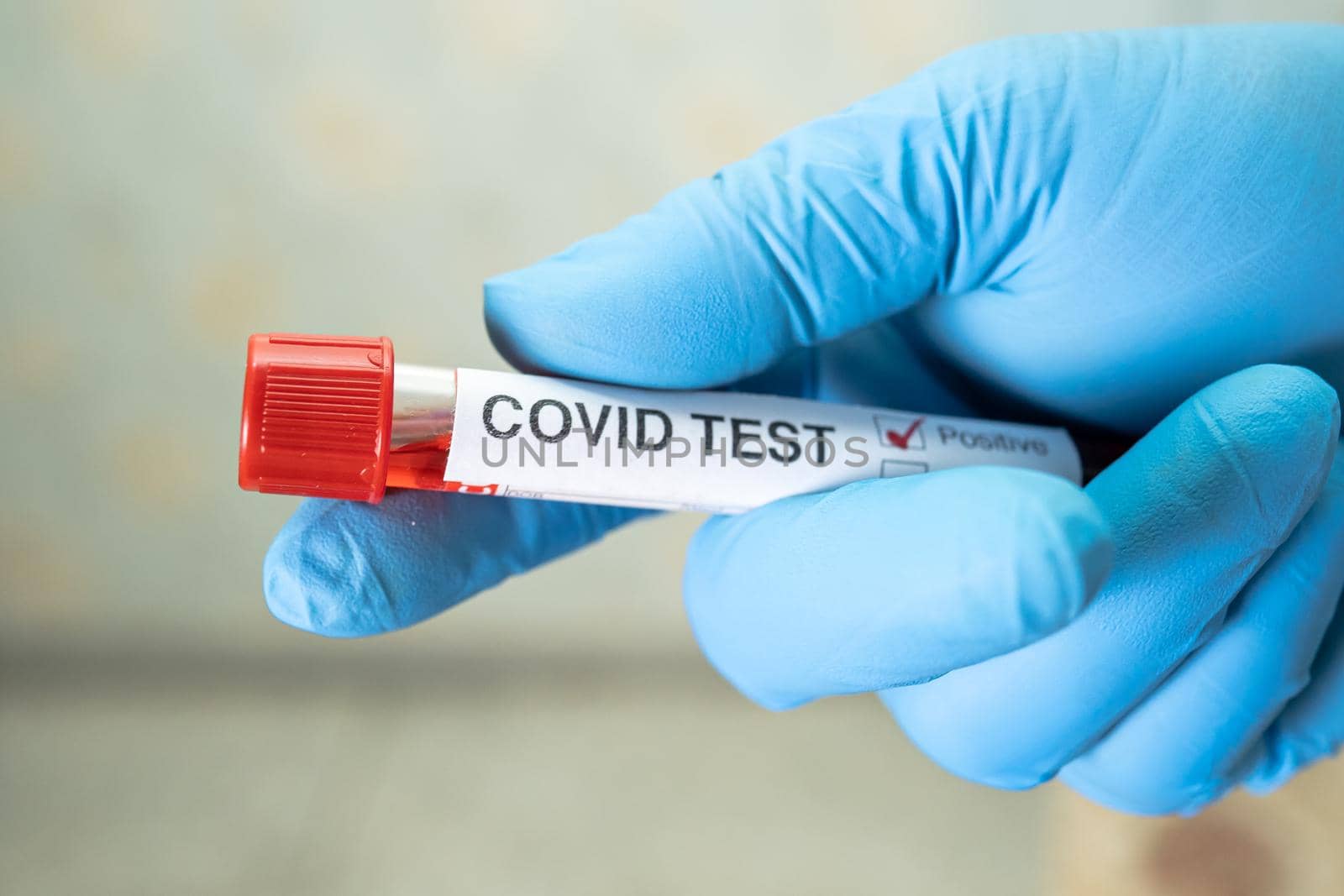 Positive blood infection sample in test tube for covid-19 coronavirus in lab. Scientist holding to check and analyze for patient in hospital.