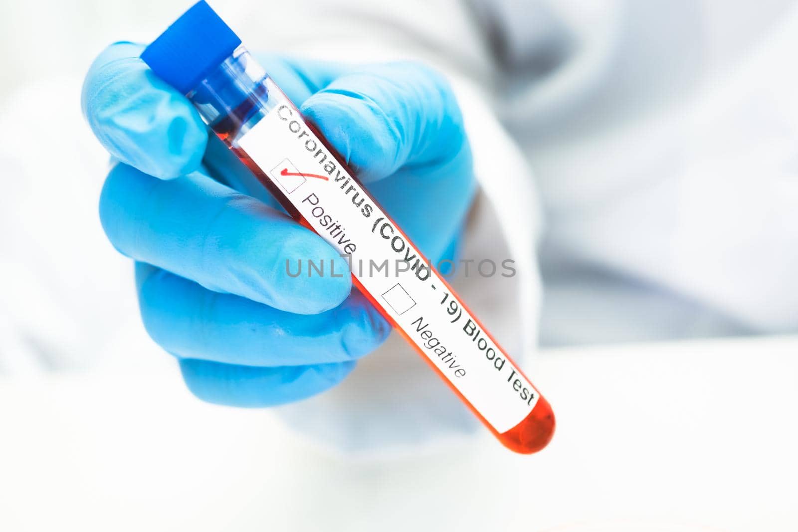 Positive blood infection sample in test tube for covid-19 coronavirus in lab. Scientist holding to check and analyze for patient in hospital.