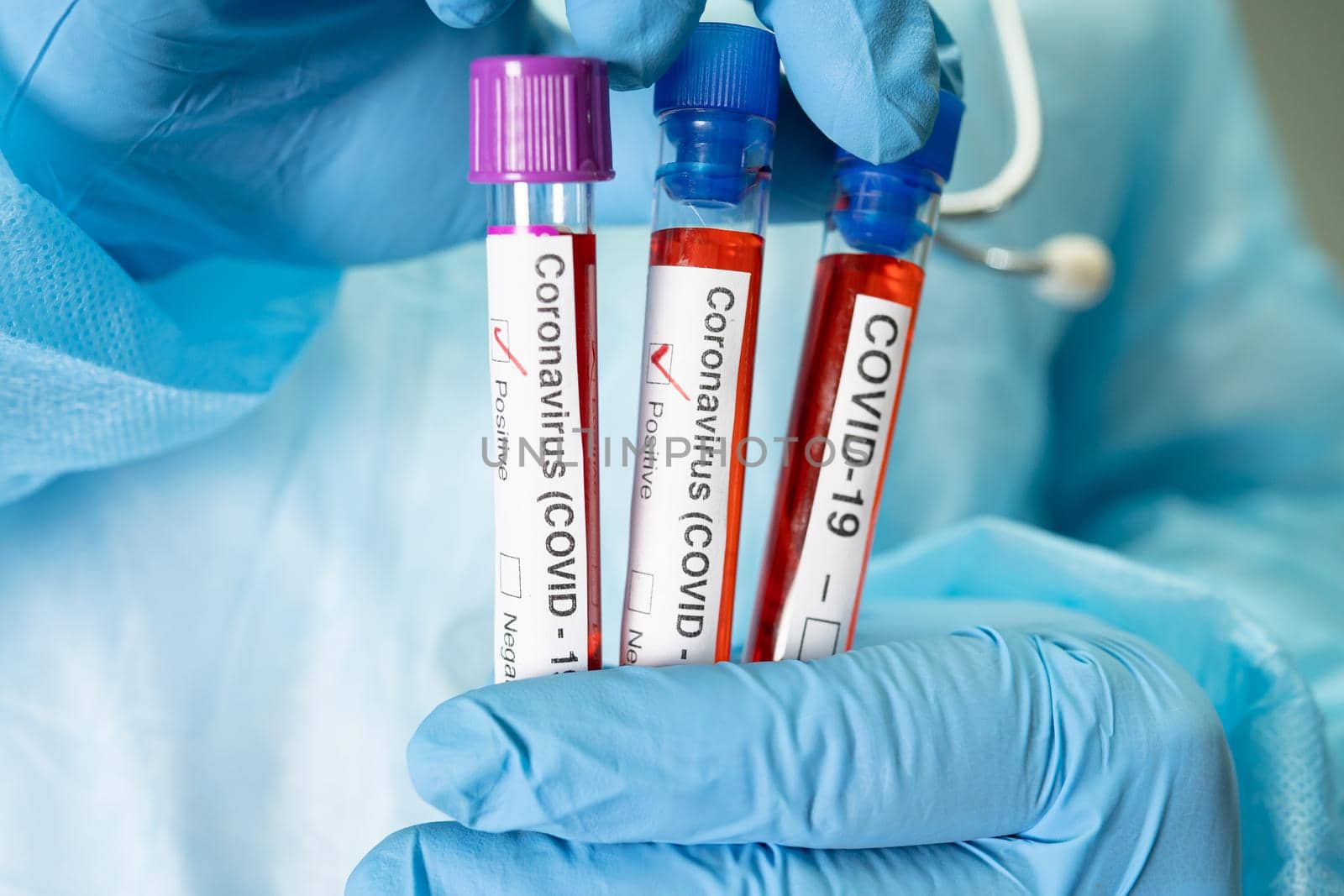 Positive blood infection sample in test tube for covid-19 coronavirus in lab. Scientist holding to check and analyze for patient in hospital. by pamai