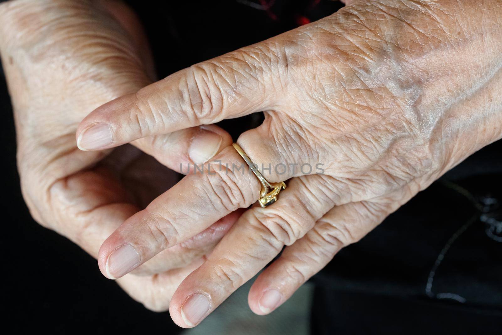 Elderly woman try to remove stuck ring off a swollen finger