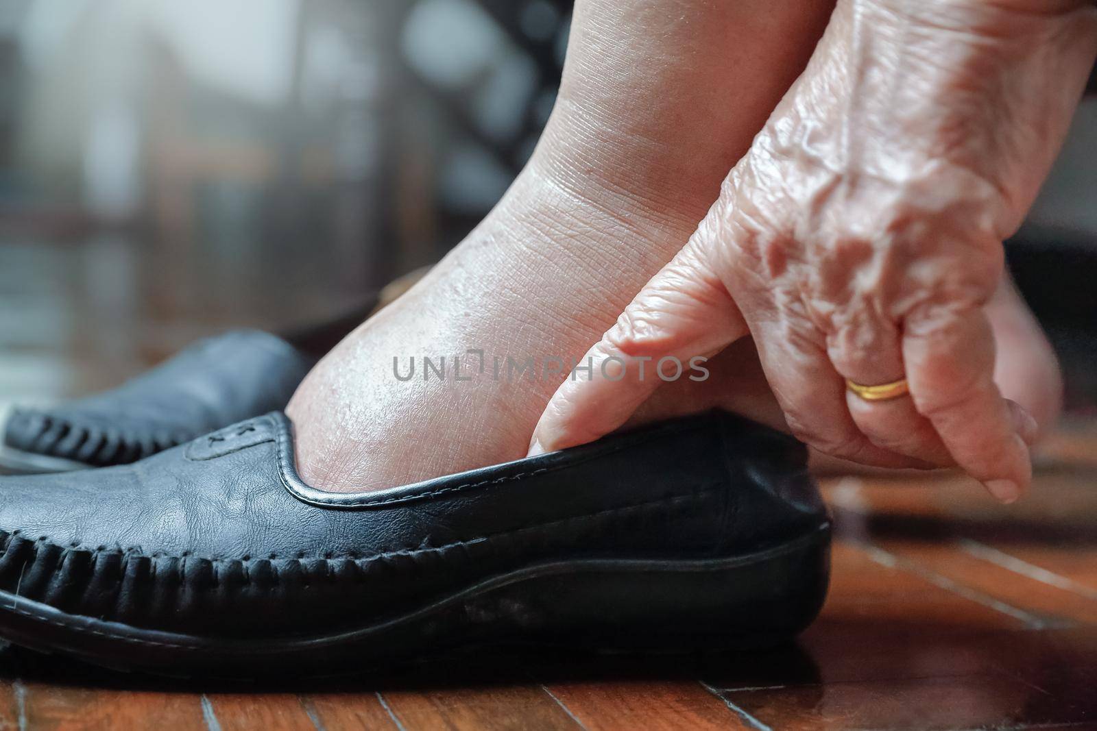 Elderly woman swollen feet putting on shoes by toa55