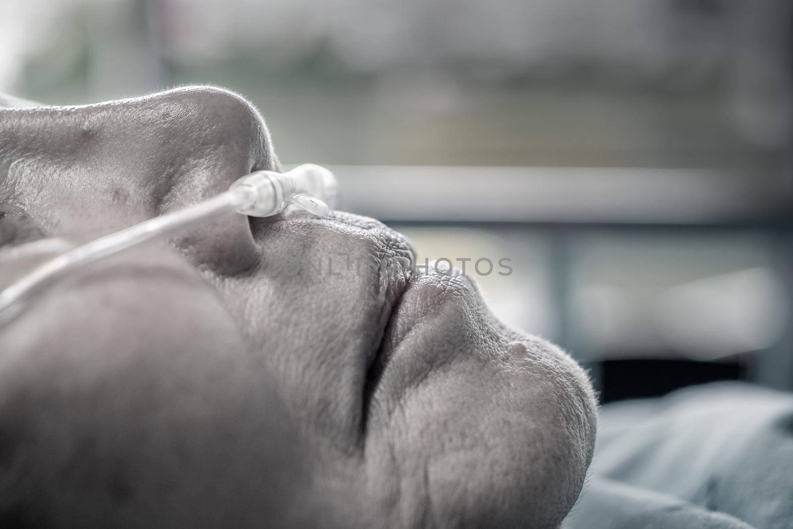 Elderly woman with nasal breathing tube to help with her breathing by toa55