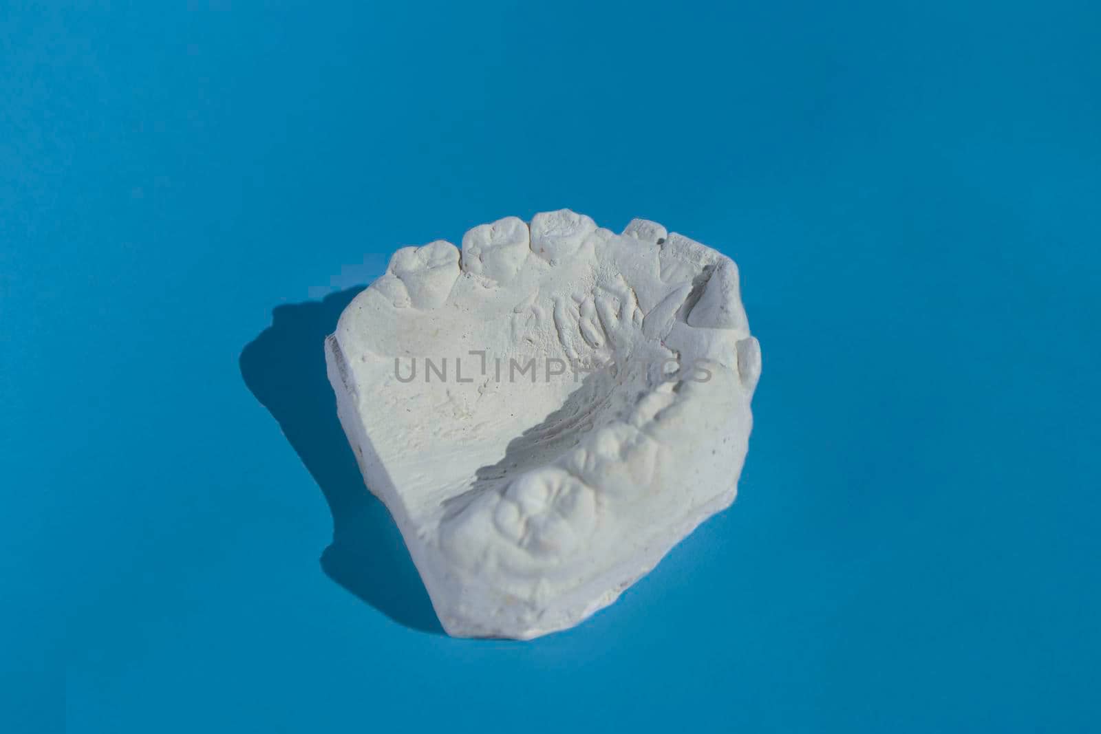 Dental casting gypsum model plaster cast stomatologic human jaws prothetic laboratory. High quality photo