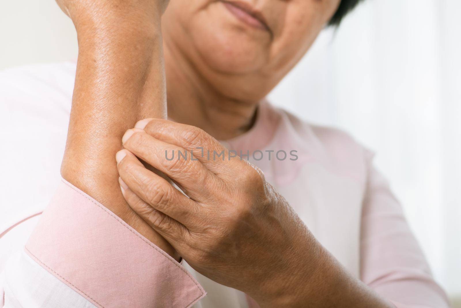 senior women scratch arm the itch on eczema arm, healthcare and medicine concept by psodaz