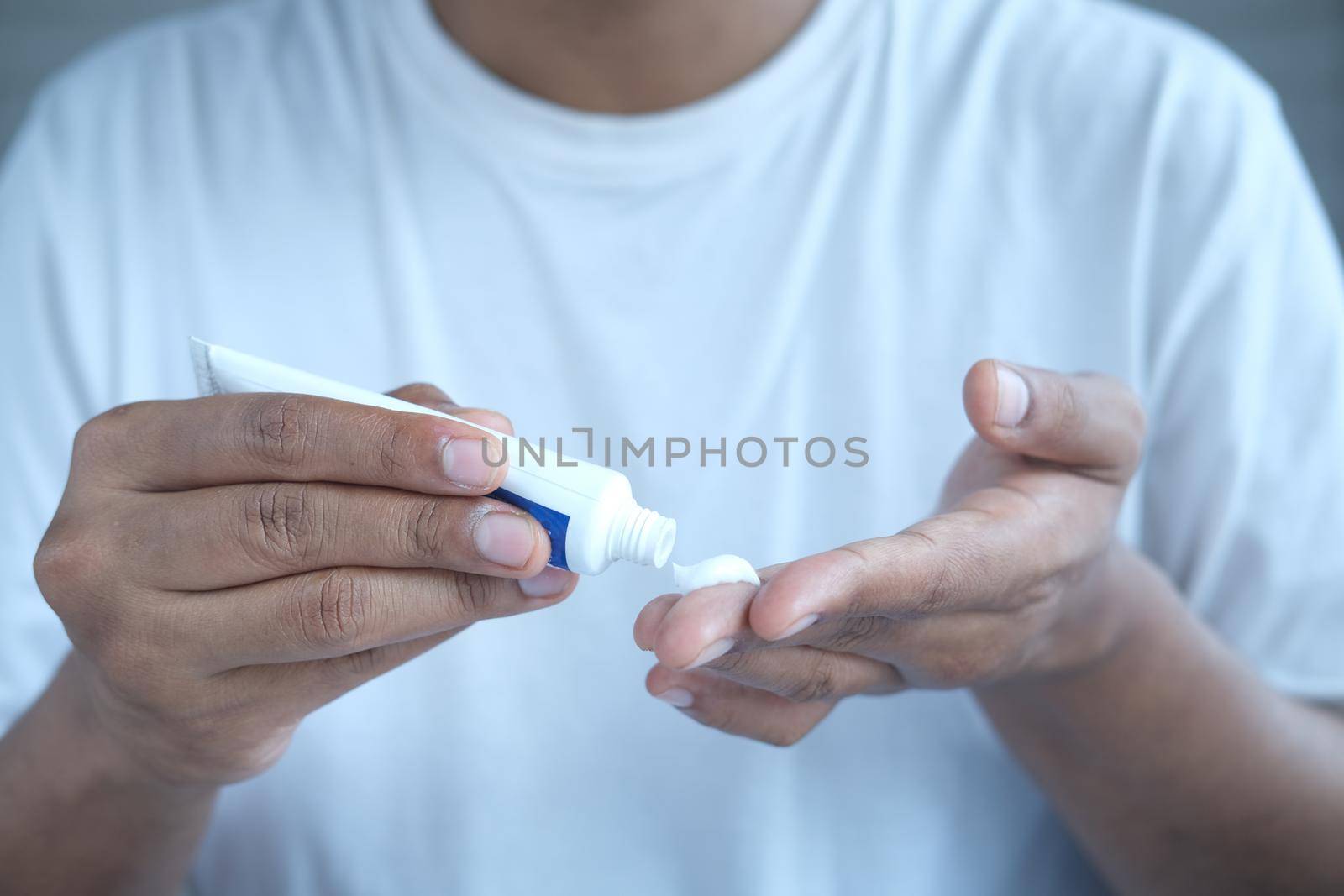 Man applying antibiotic cream