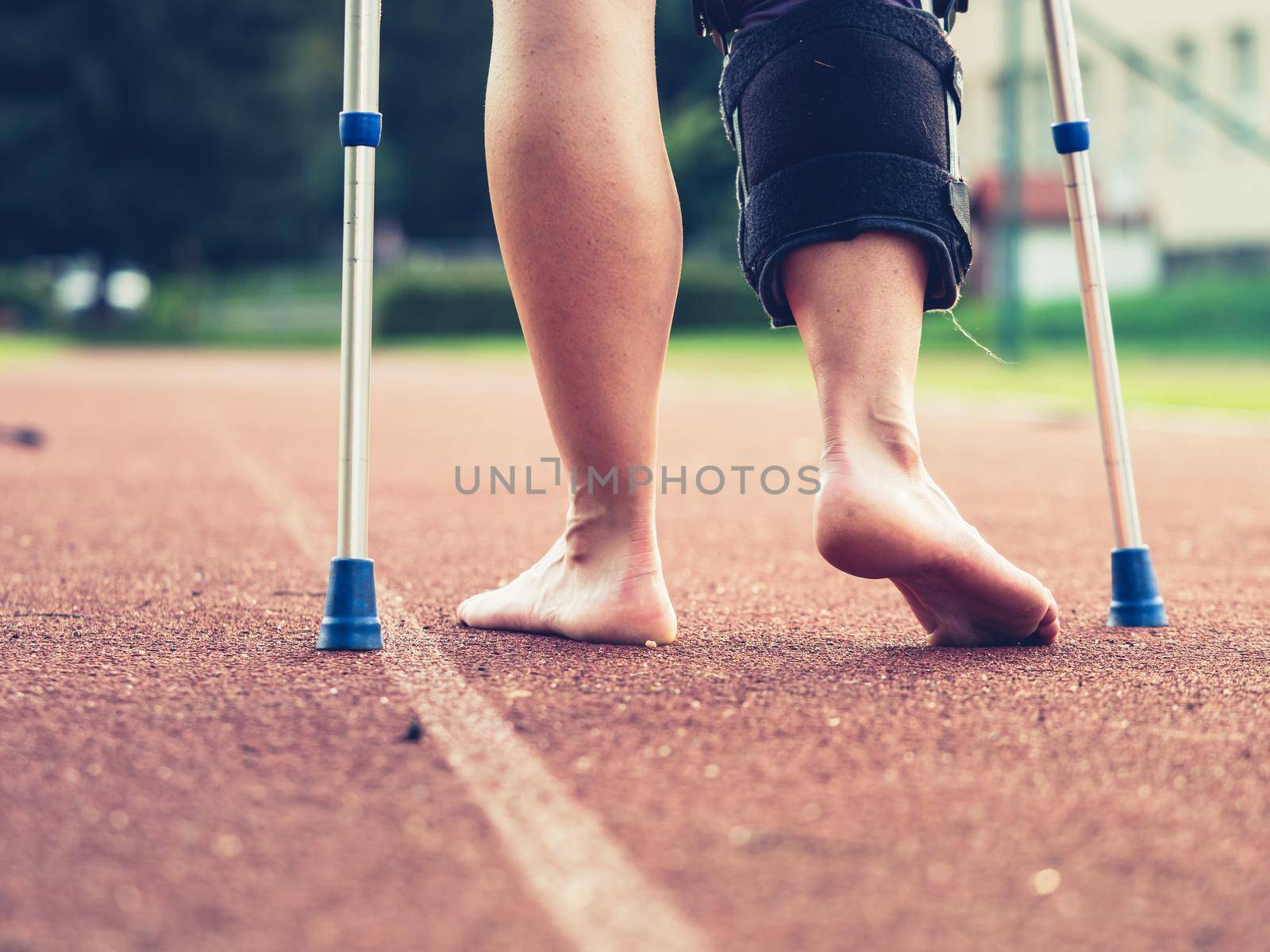 Woman athlete on crutches, wearing a wrist brace and knee support,  by rdonar2