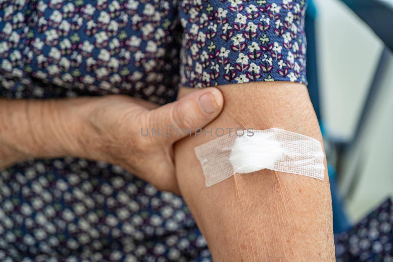 Asian senior or elderly old lady woman patient show cotton wool stop bleeding, after blood drawing testing for annually physical health check up to check cholesterol, blood pressure, and sugar level. by pamai