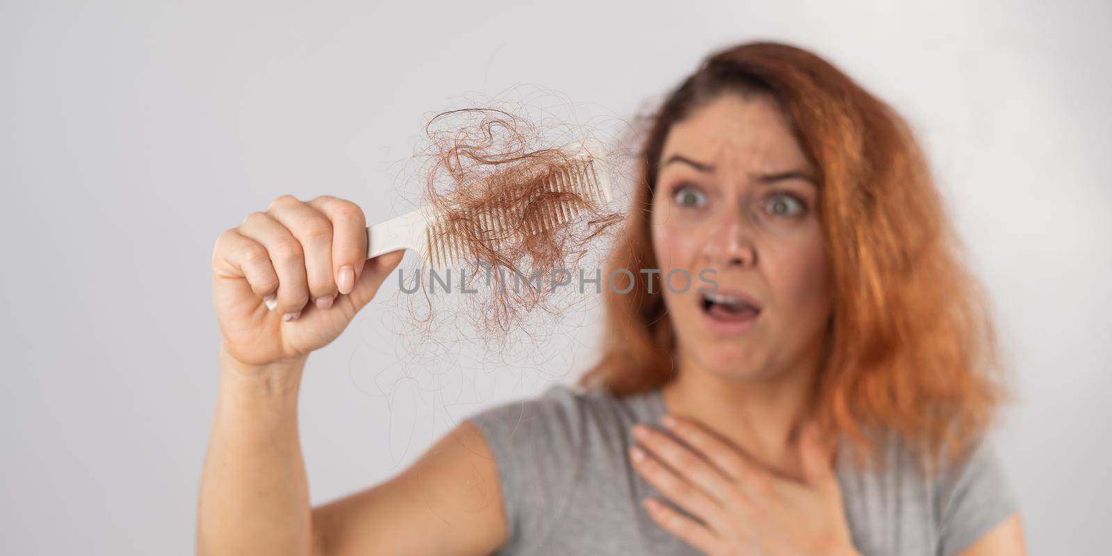 Caucasian woman with a grimace of horror holds a comb with a bun of hair. Hair loss and female alopecia