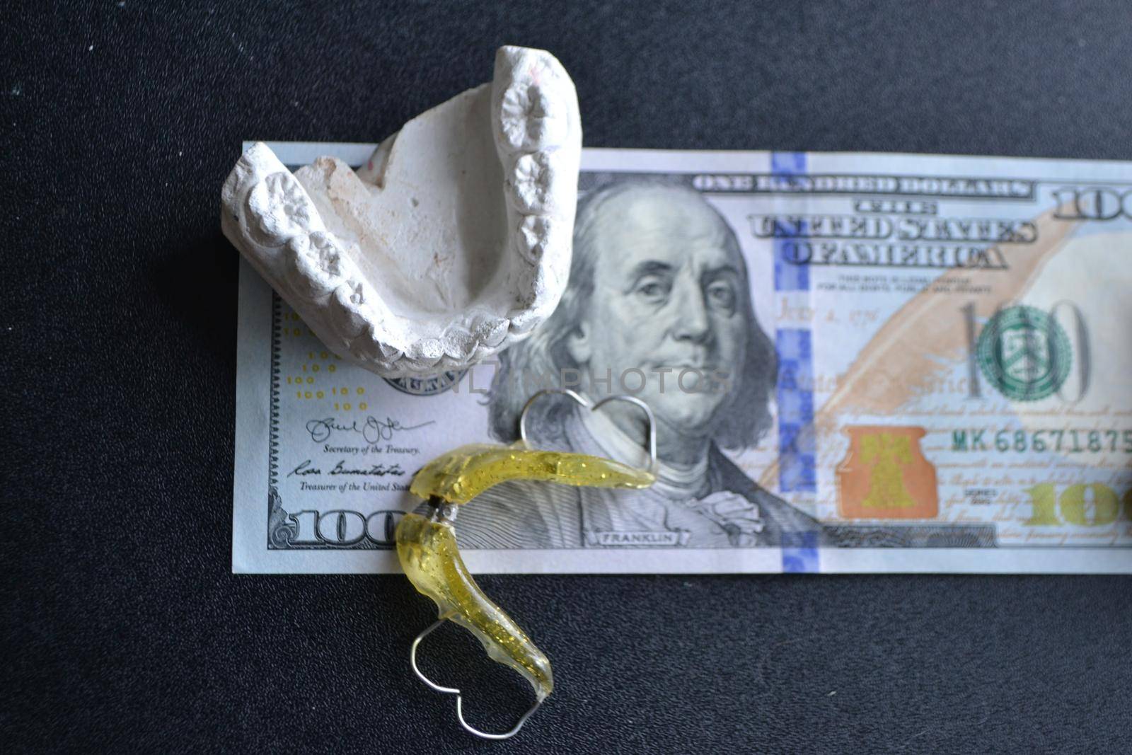 Plaster cast of teeth and dental plate on the background of money and dental x-ray. Dental examination and dental treatment concept. High quality photo