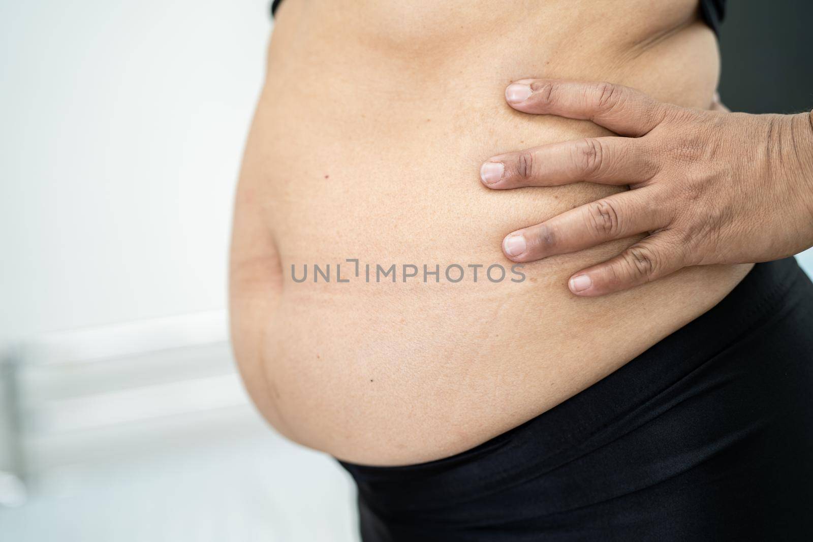 Overweight Asian woman show fat belly at office.