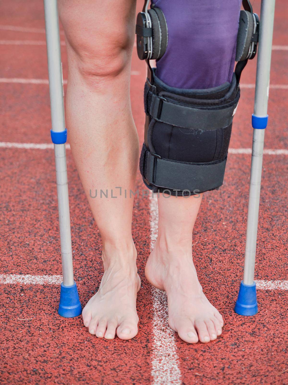 Woman suffering with walk by sticks and knee brace support surgery  by rdonar2