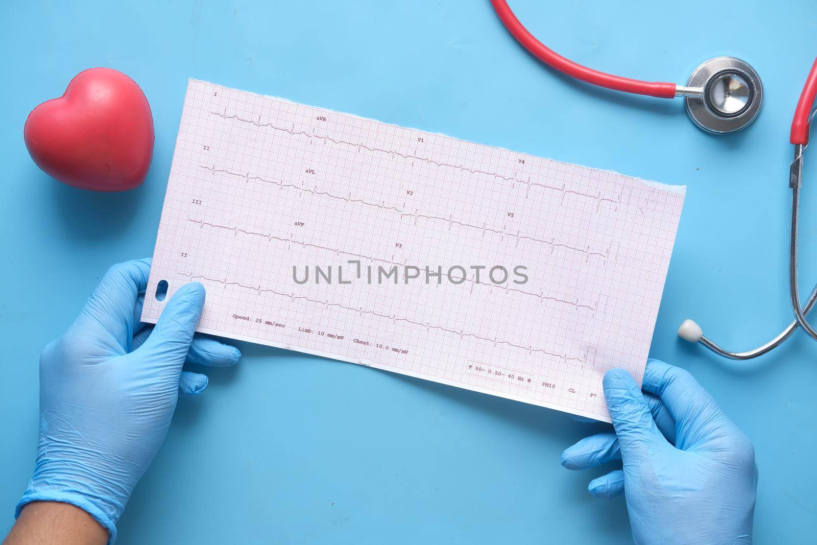 doctor hand in medical gloves analyzing cardio diagram. by towfiq007