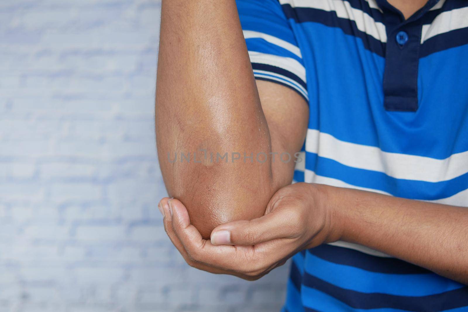 young man suffering pain on elbow by towfiq007