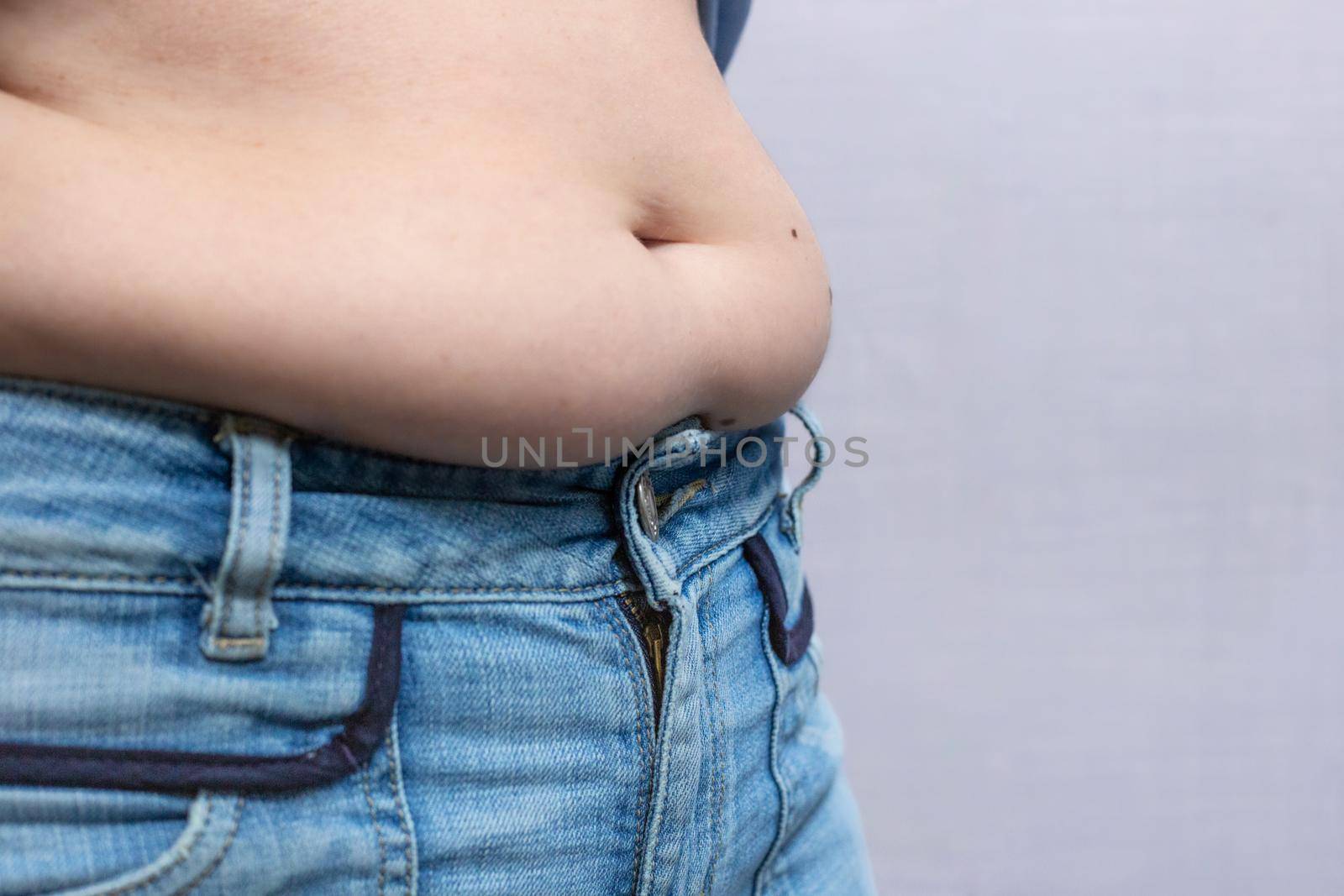 overweight woman, large belly with folds of fat, with copy space