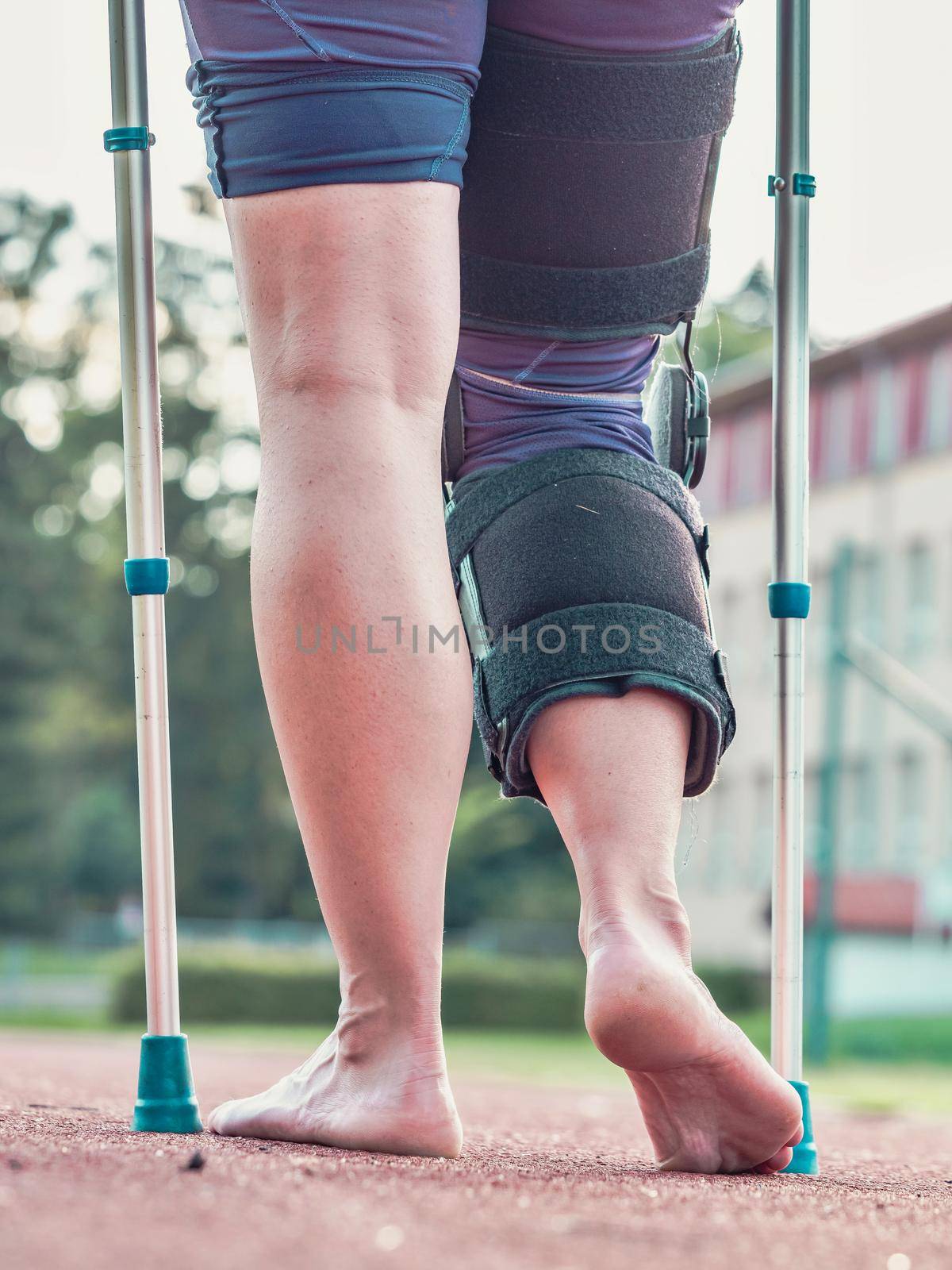 Woman walks with knee brace after an injury by medical sticks by rdonar2