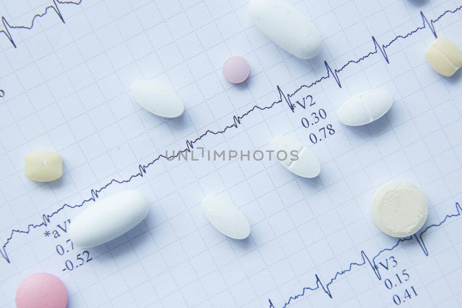 prescription medical pills on a cardio diagram