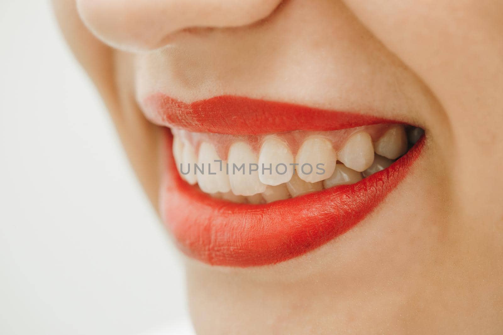 Laughing woman smile with great teeth. Close up portrait of beautiful young happy smiling woman, isolated over white background. by uflypro