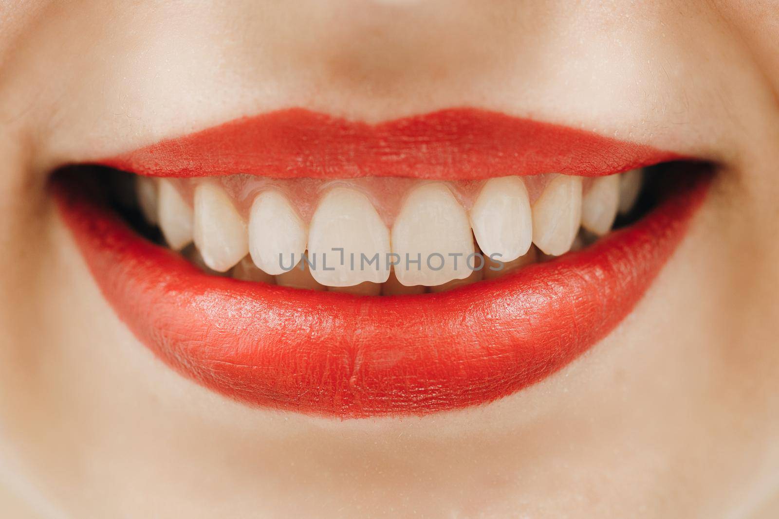 Perfect smile after bleaching. Dental care and whitening teeth. Stomatology and beauty care. Woman smiling with great teeth. Cheerful female smile with fresh clear skin. by uflypro