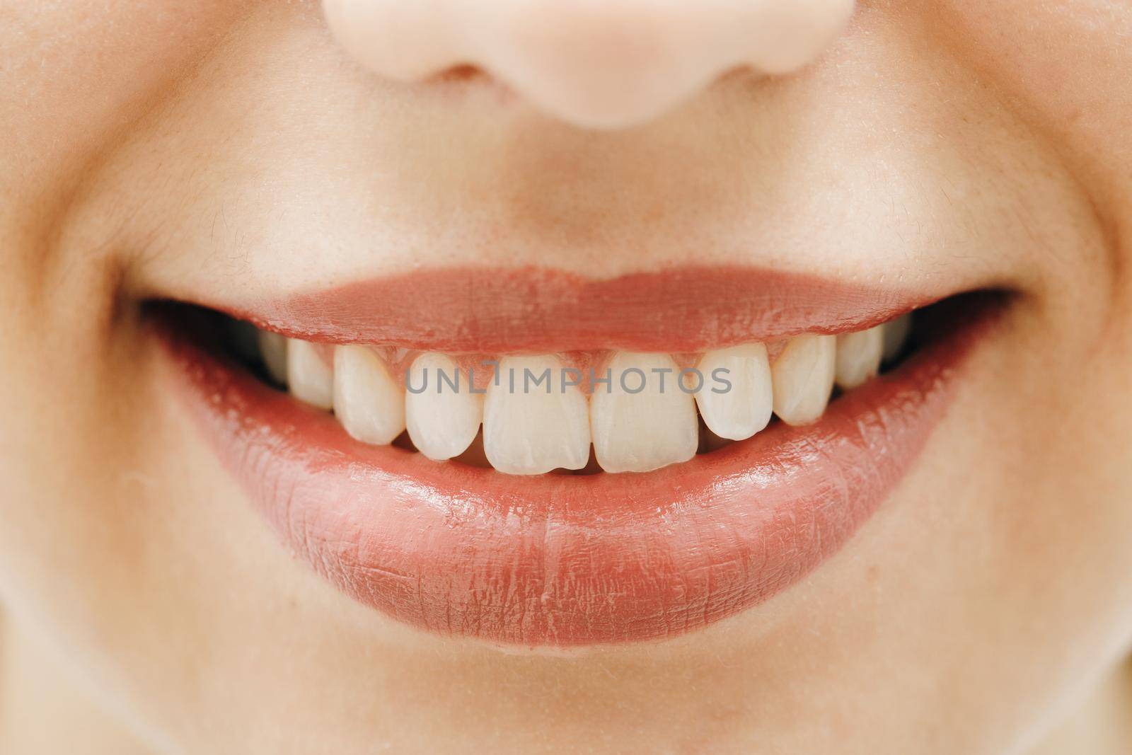 Wide smile of young fresh woman with great healthy white teeth. Closeup of woman smiling with prefect white teeth by uflypro
