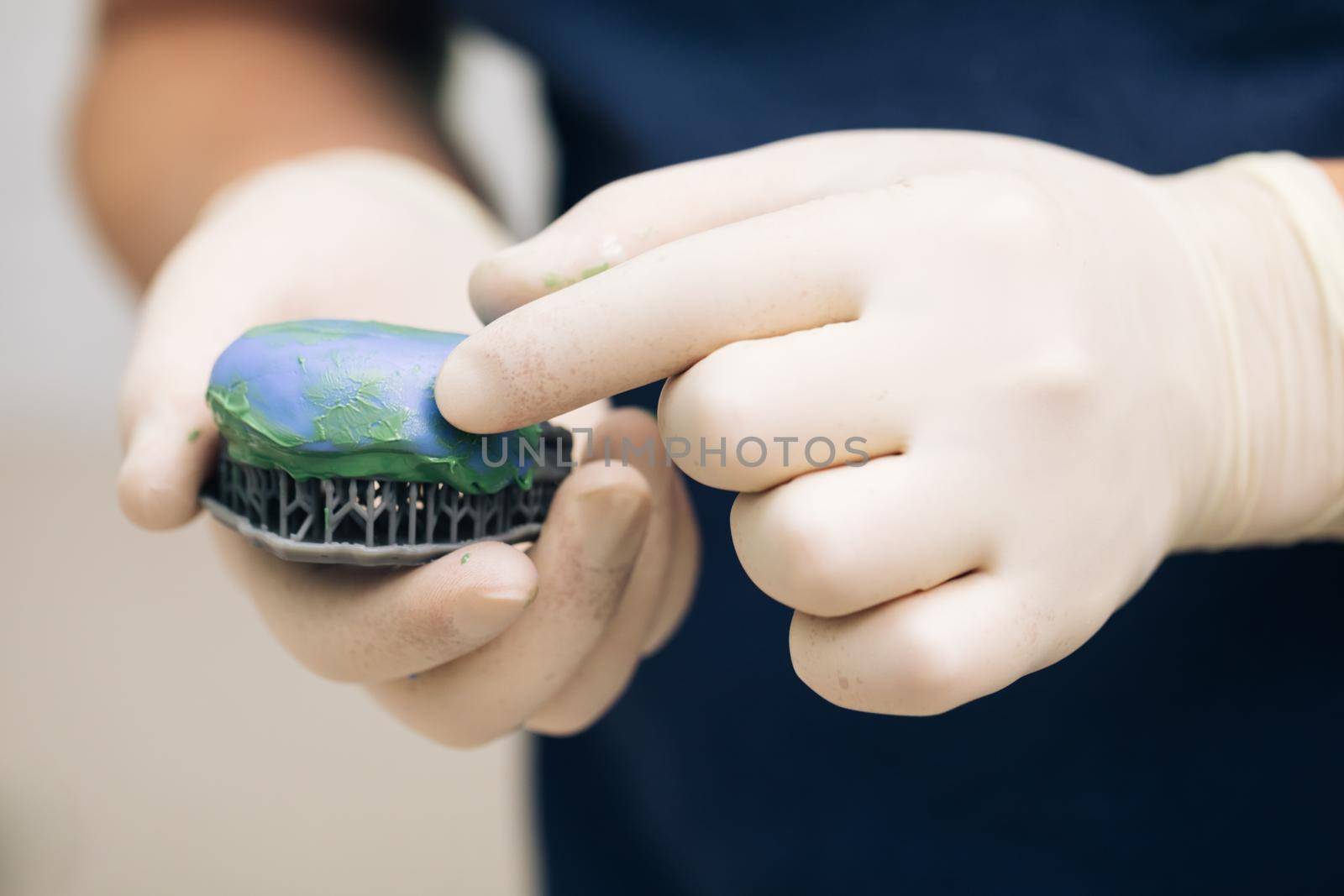 Dental technician making of denture in a dental lab. Making a template for temporary veneers with A-silicone and printed plastic 3D model. Oral surgeon making wax-up impressions.