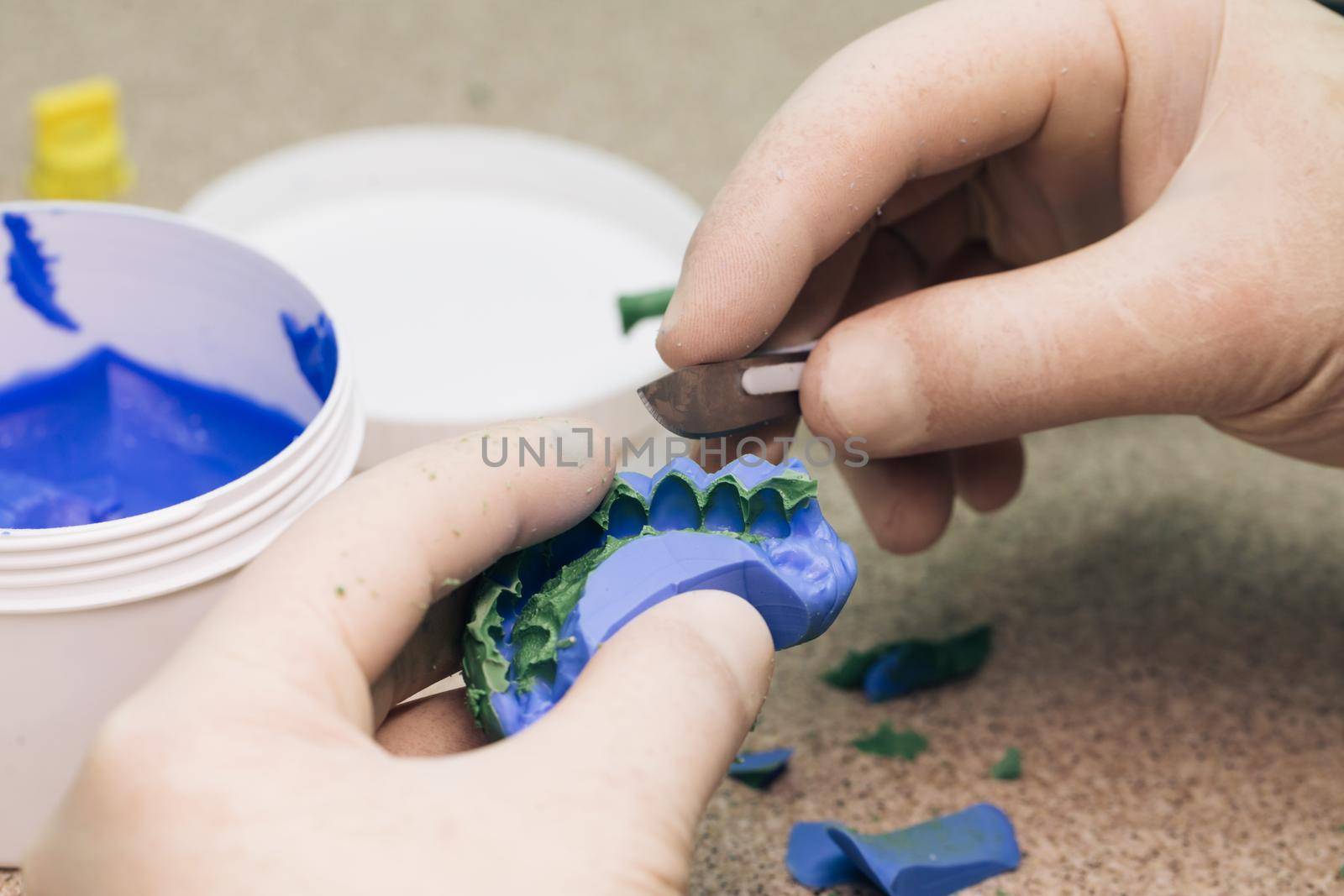 Making a template for temporary veneers with A-silicone. Dentist work in modern dental clinic. Dental technician making of denture in a dental lab.