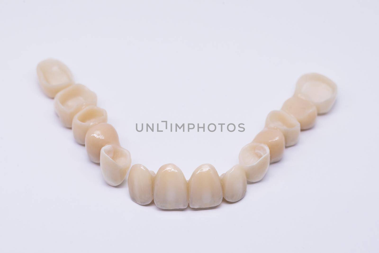 Beautiful dental bridge isolated on wite made of ceramic porcelain. Aesthetic restoration of tooth loss. Ceramic zirconium in final version. Metal Free Ceramic Dental Crowns.