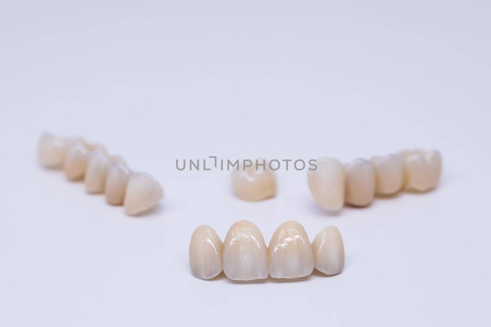 Metal Free Ceramic Dental Crowns. Ceramic zirconium in final version. Staining and glazing. Precision design and high quality materials by uflypro
