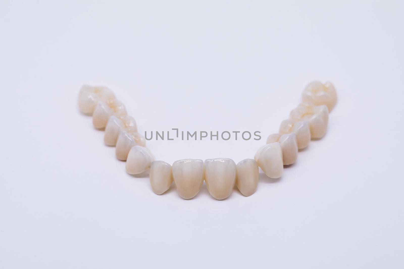 Metal Free Ceramic Dental Crowns. Ceramic zirconium in final version. Staining and glazing. Precision design and high quality materials. by uflypro