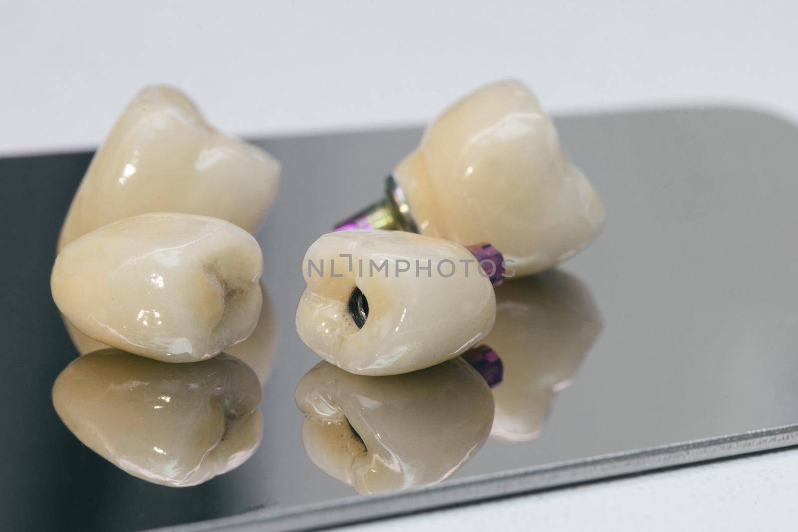 Dental health care. Dental dentist objects. Dental zirconium implants