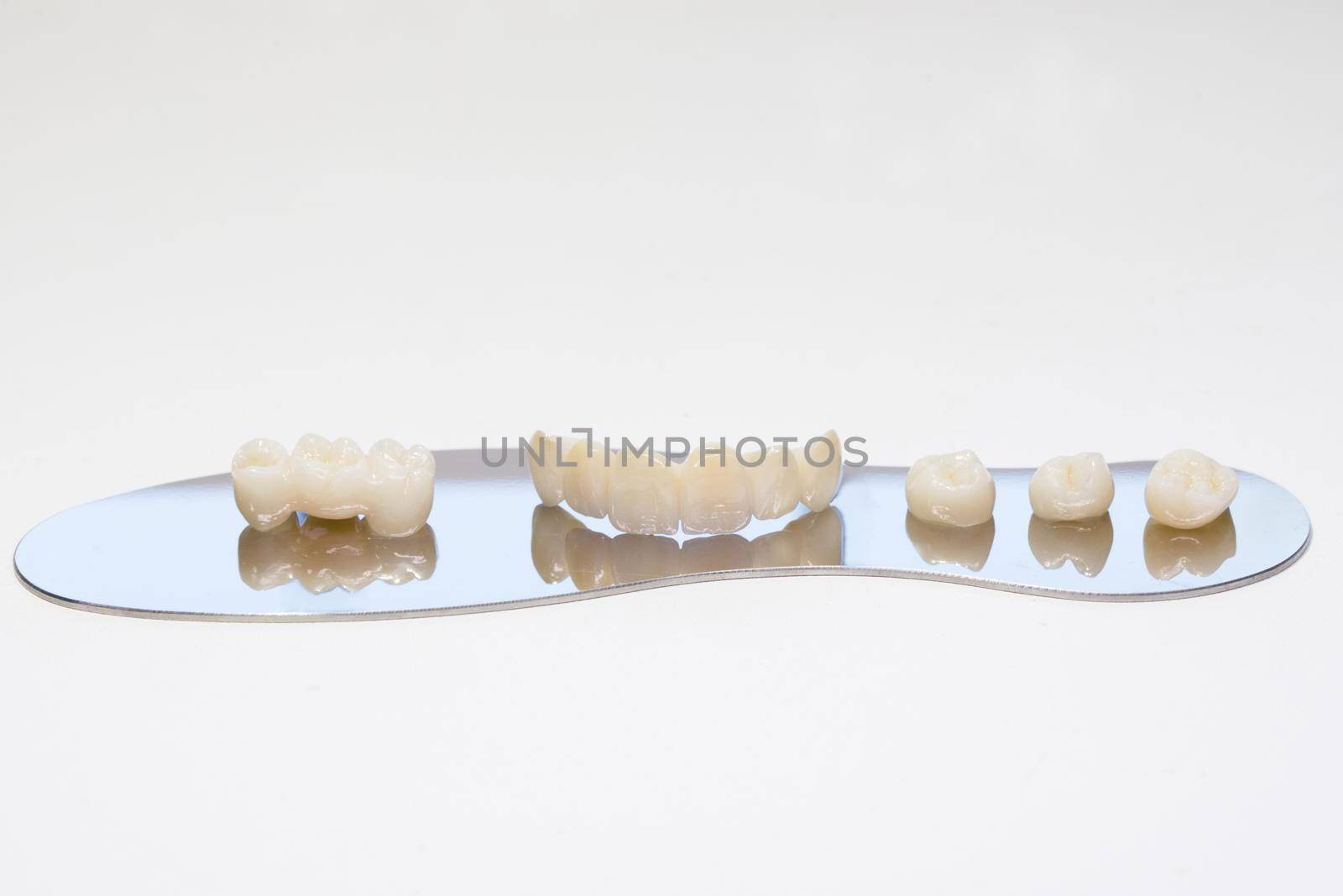 Ceramic zirconium in final version. Metal Free Ceramic Dental Crowns. Zirconium tooth crown. Isolate on background. Aesthetic restoration of tooth loss.