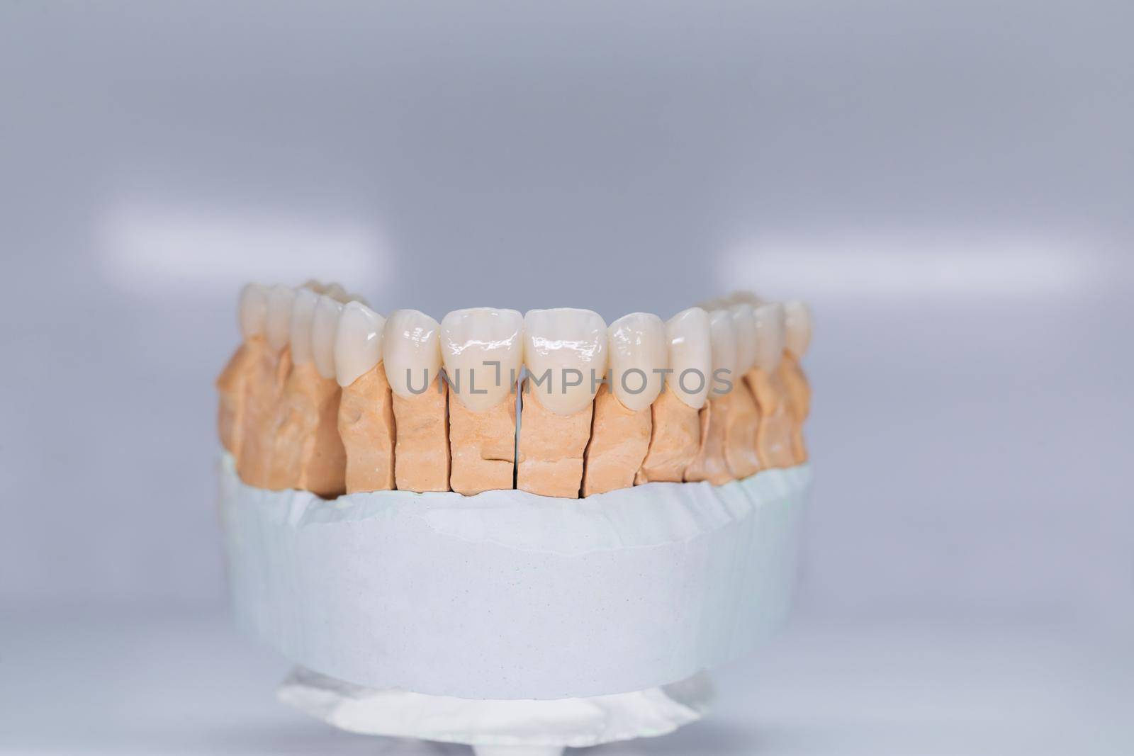 Ceramic tooth crown on plaster model. Finished new ceramic bridge on plaster model, frontal view. Dental veneers are lying on a wite background in the laboratory by uflypro