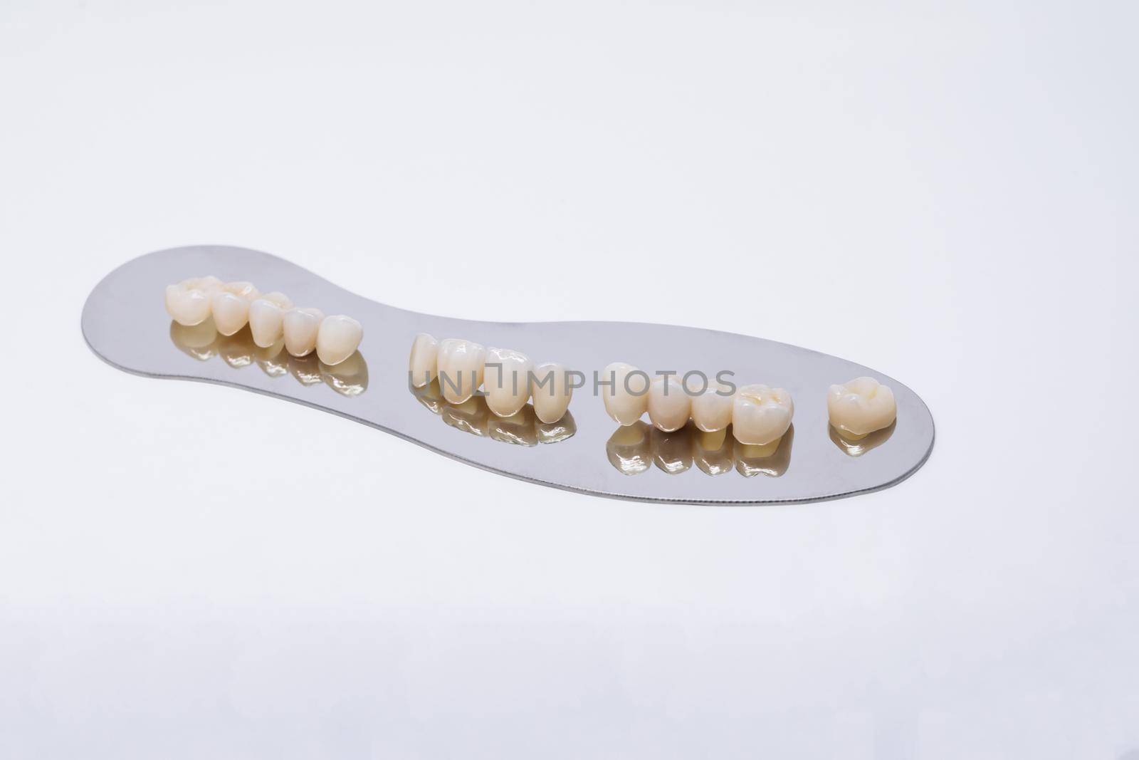 Ceramic zirconium in final version. Metal Free Ceramic Dental Crowns. Zirconium tooth crown Isolate on wite background. Aesthetic restoration of tooth loss.
