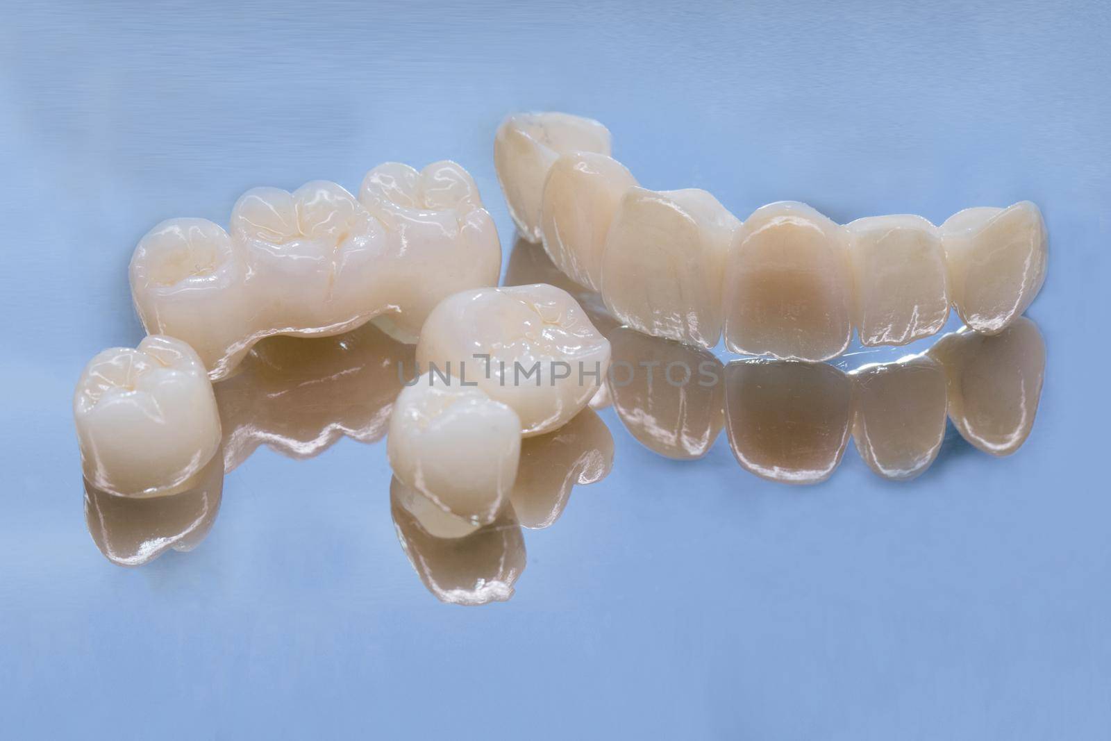 Metal Free Ceramic Dental Crowns. Ceramic zirconium in final version. Staining and glazing. Precision design and high quality materials. by uflypro