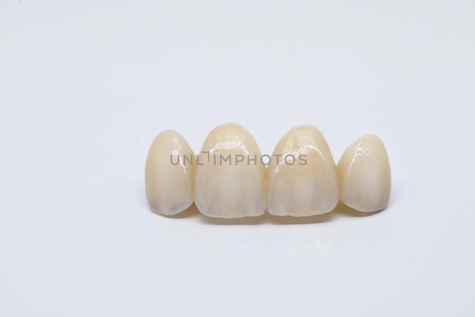 Dental ceramic bridge on isolated wite background. Metal free ceramic dental crowns. by uflypro